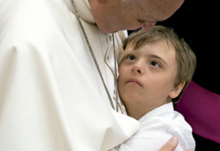 papa Francisco con un niño con discapacidad durante el Jubileo de los enfermos y personas con discapacidad 10 junio 2016